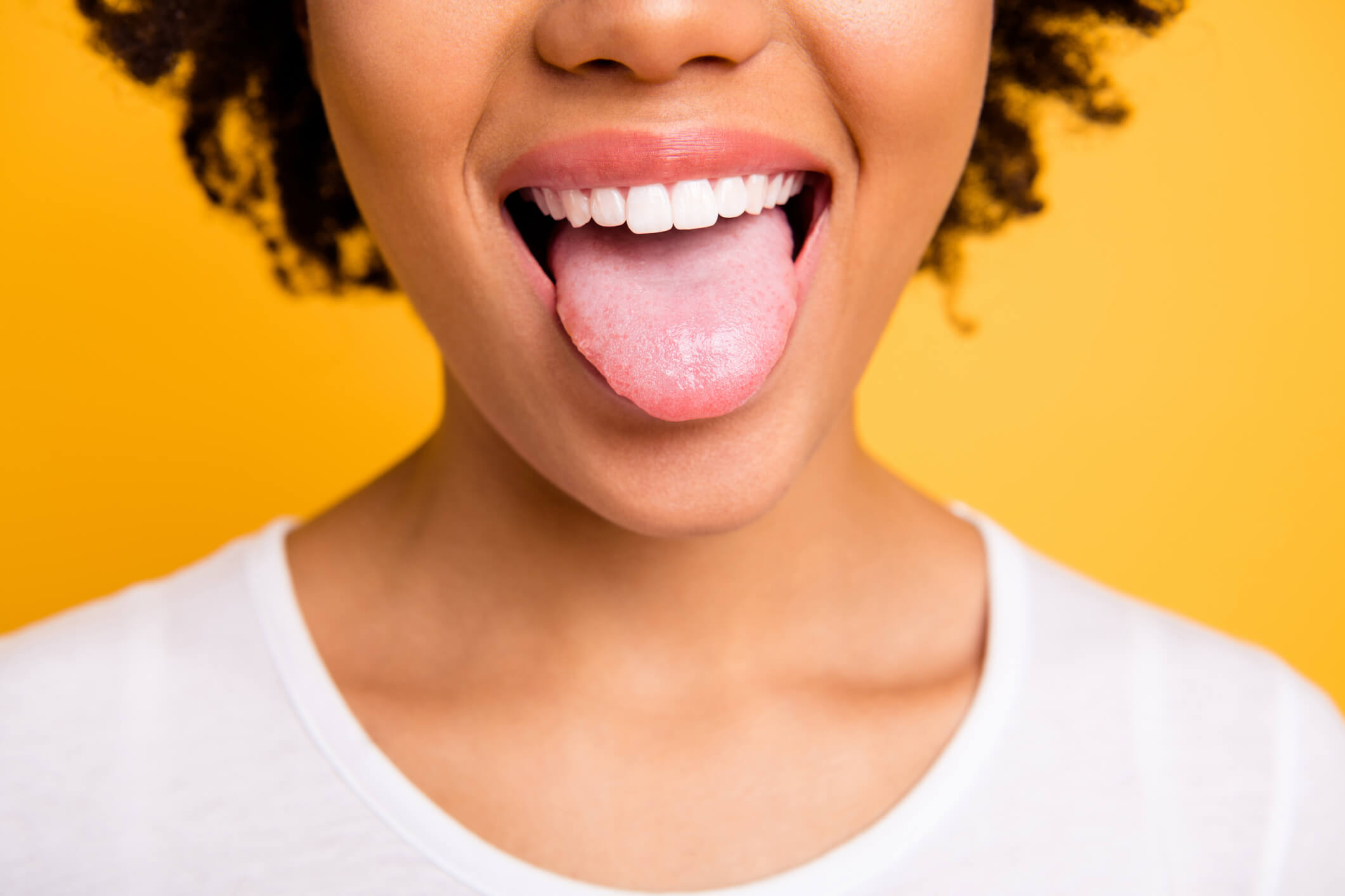 Mycose de la langue : quels sont les meilleurs traitements ?