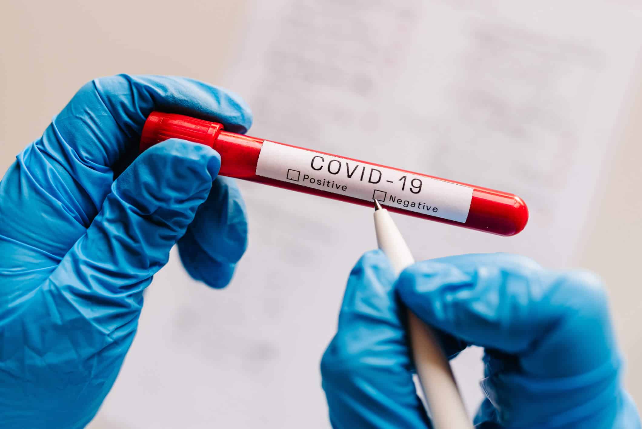 laboratoire test sérologique