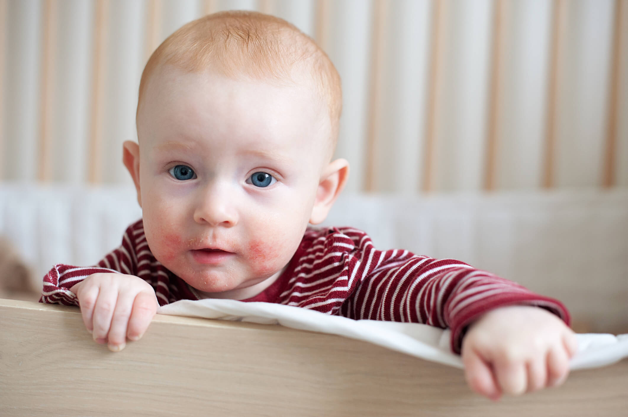 allergie enfant