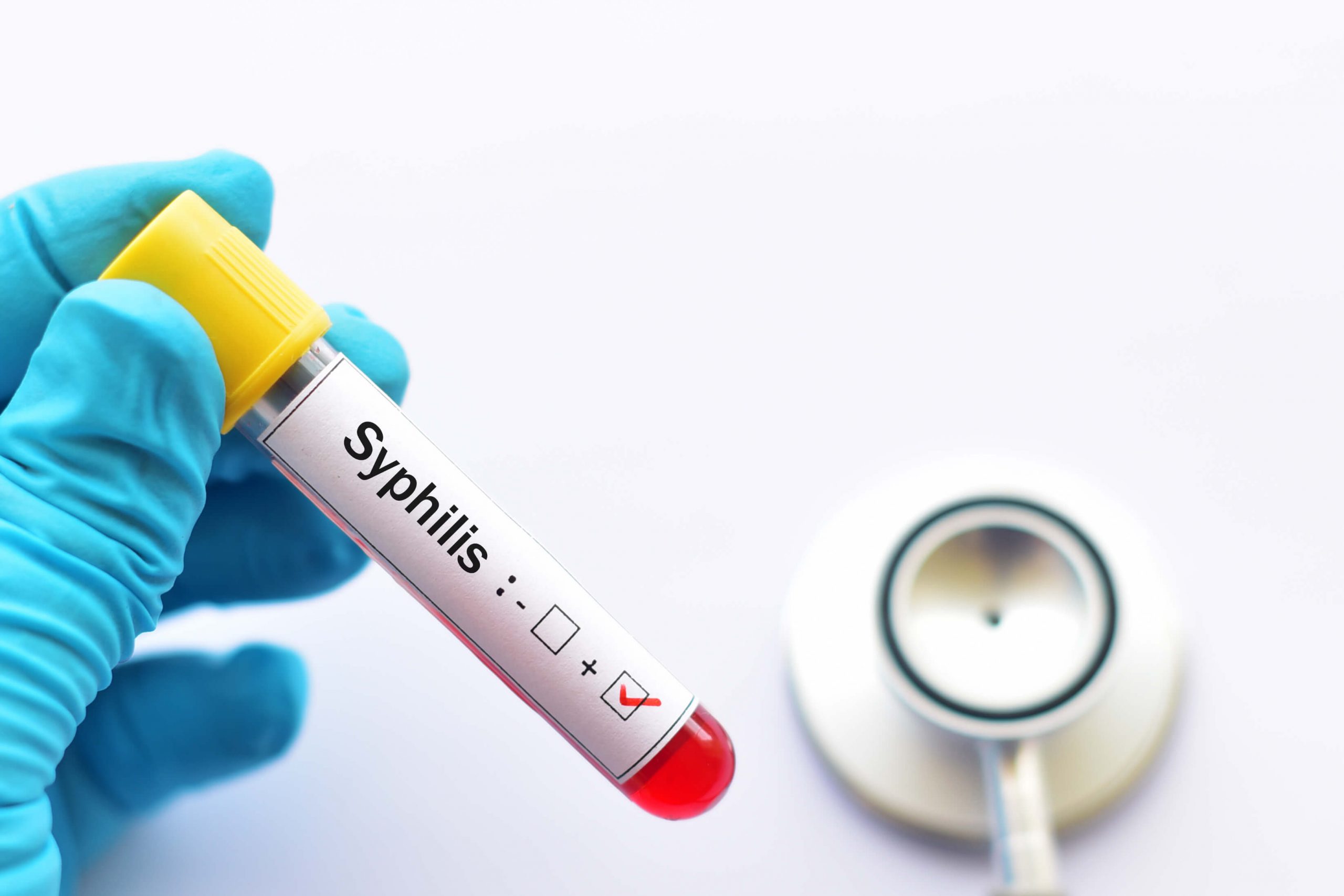 dépistage syphilis