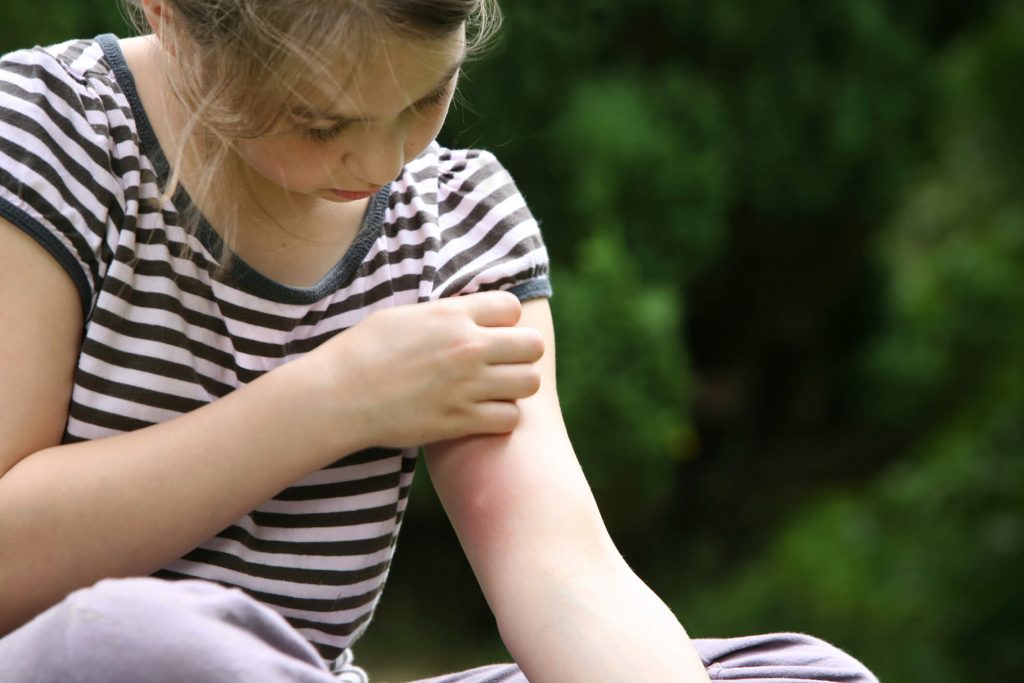 symptômes gale enfant
