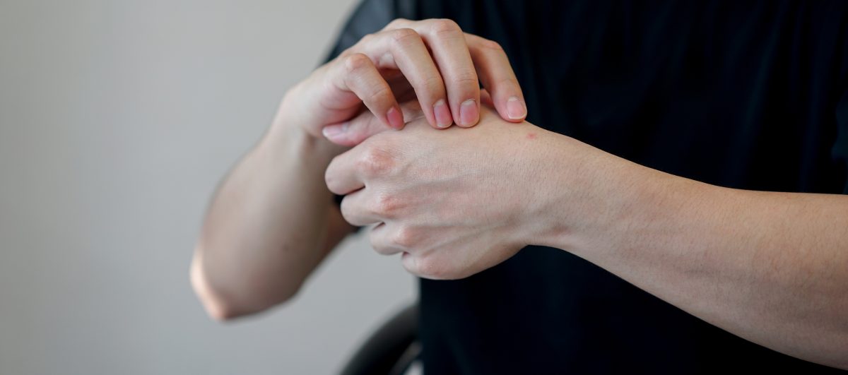 herpès à la main causes, symptômes et traitement