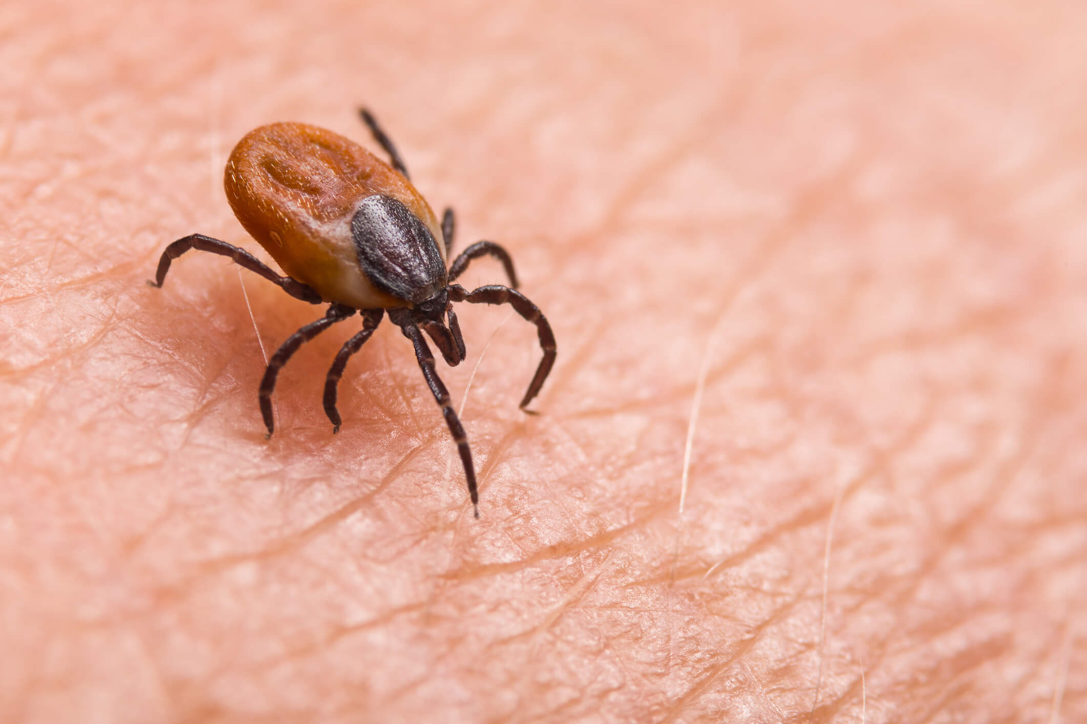 Maladie de Lyme