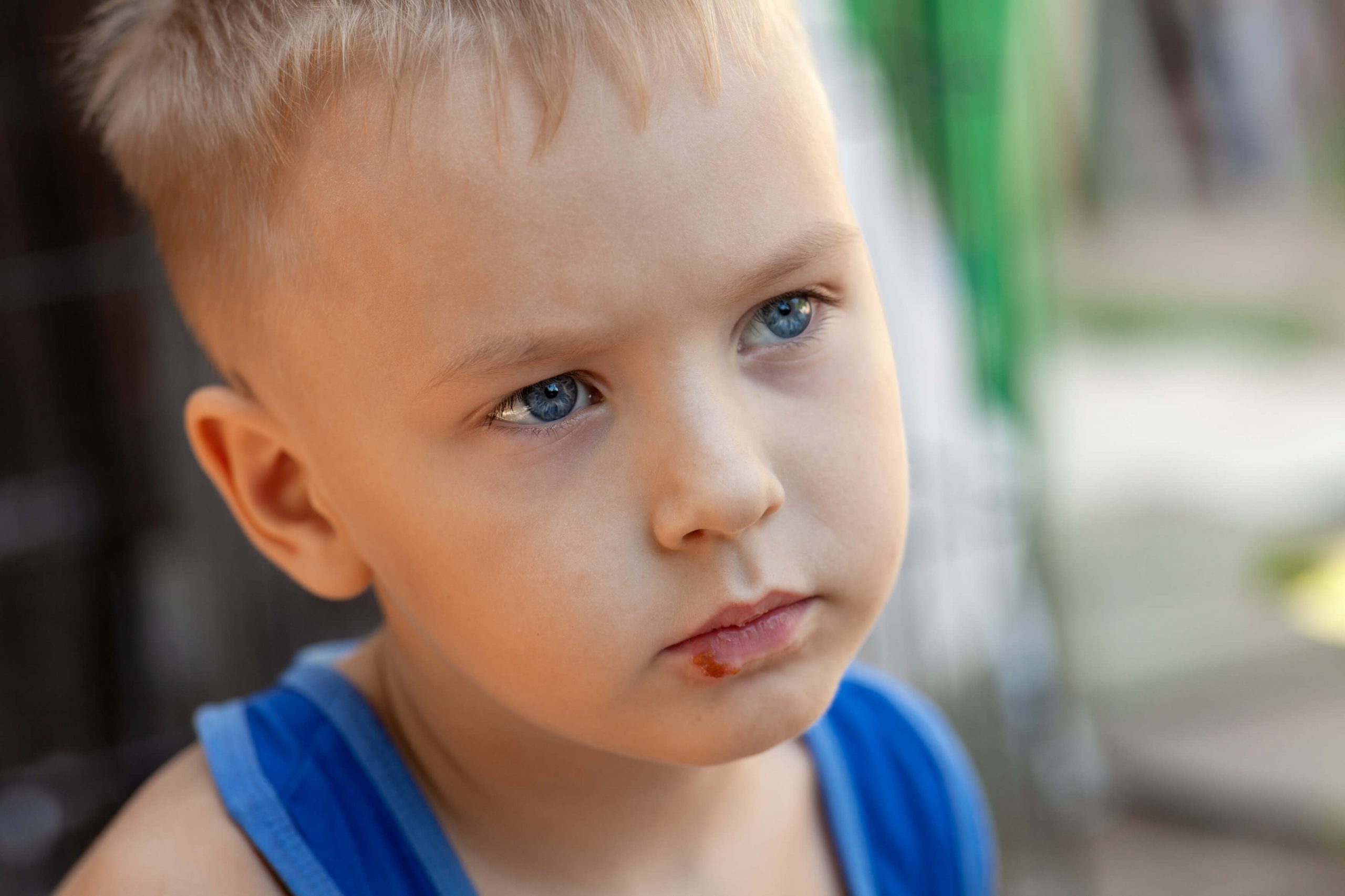 Herpès enfant : comment le reconnaître et le soigner ?