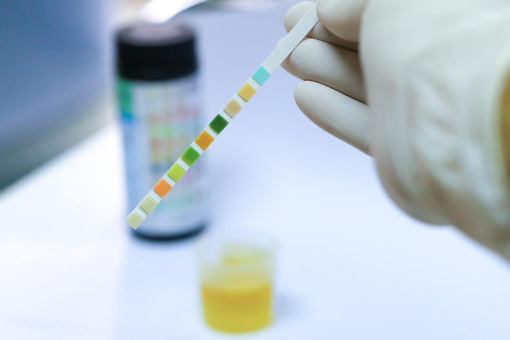 douleur rein examen urine 