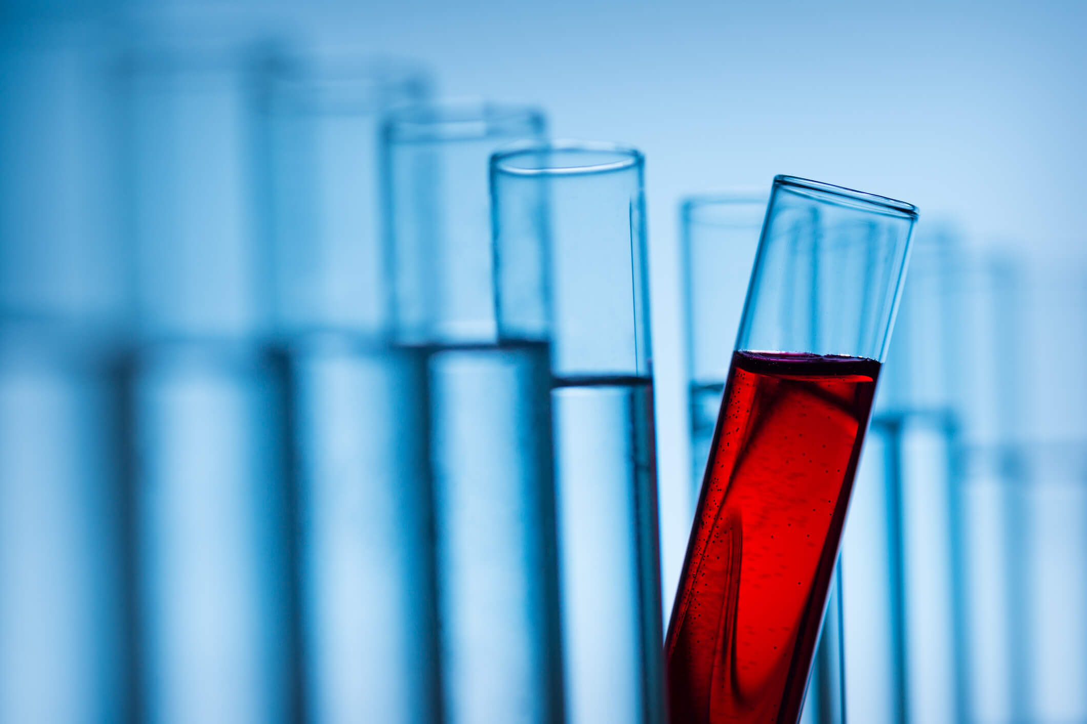 Transaminases élevées symptômes