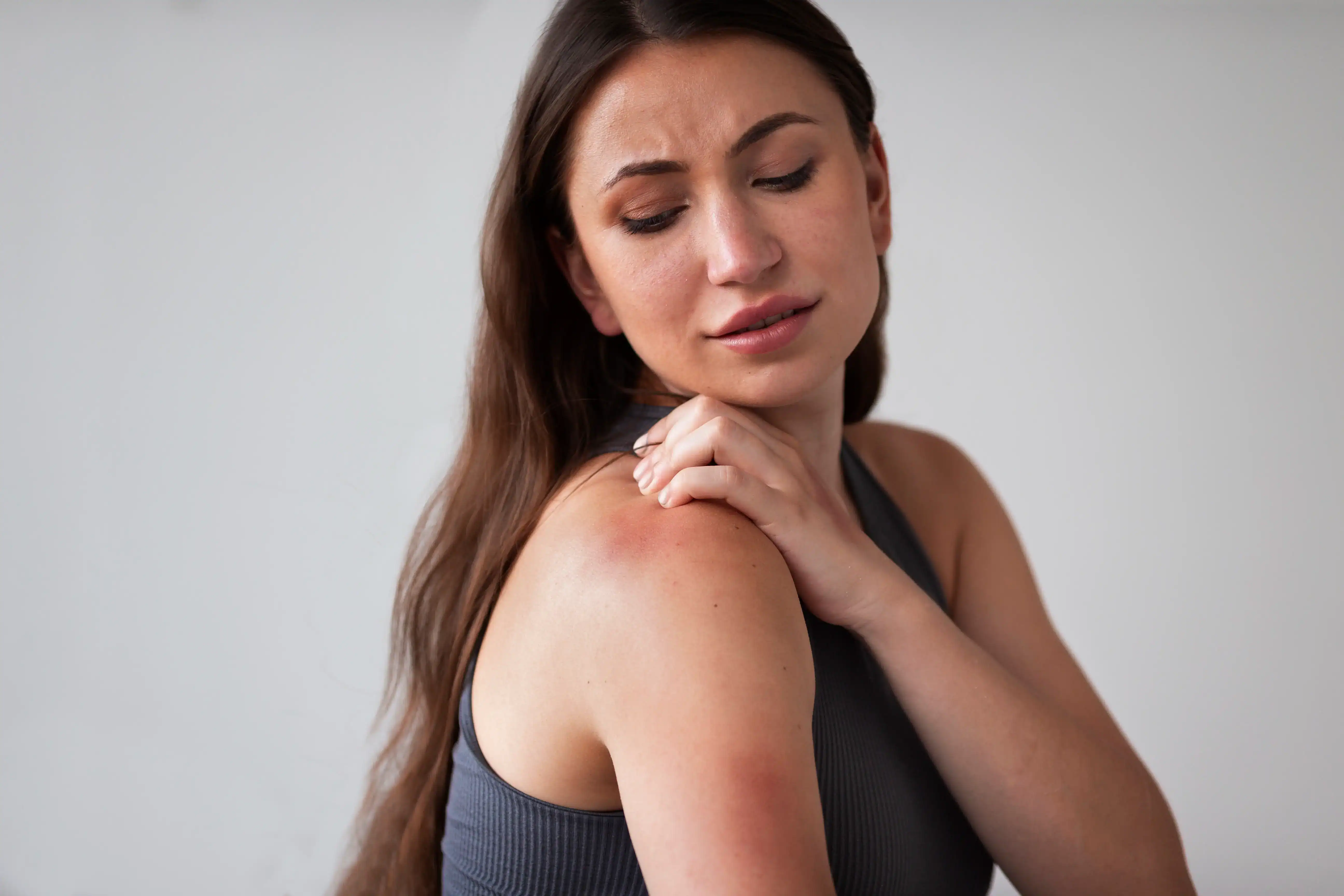 Femme qui s'est brulé l'épaule et le bras droit