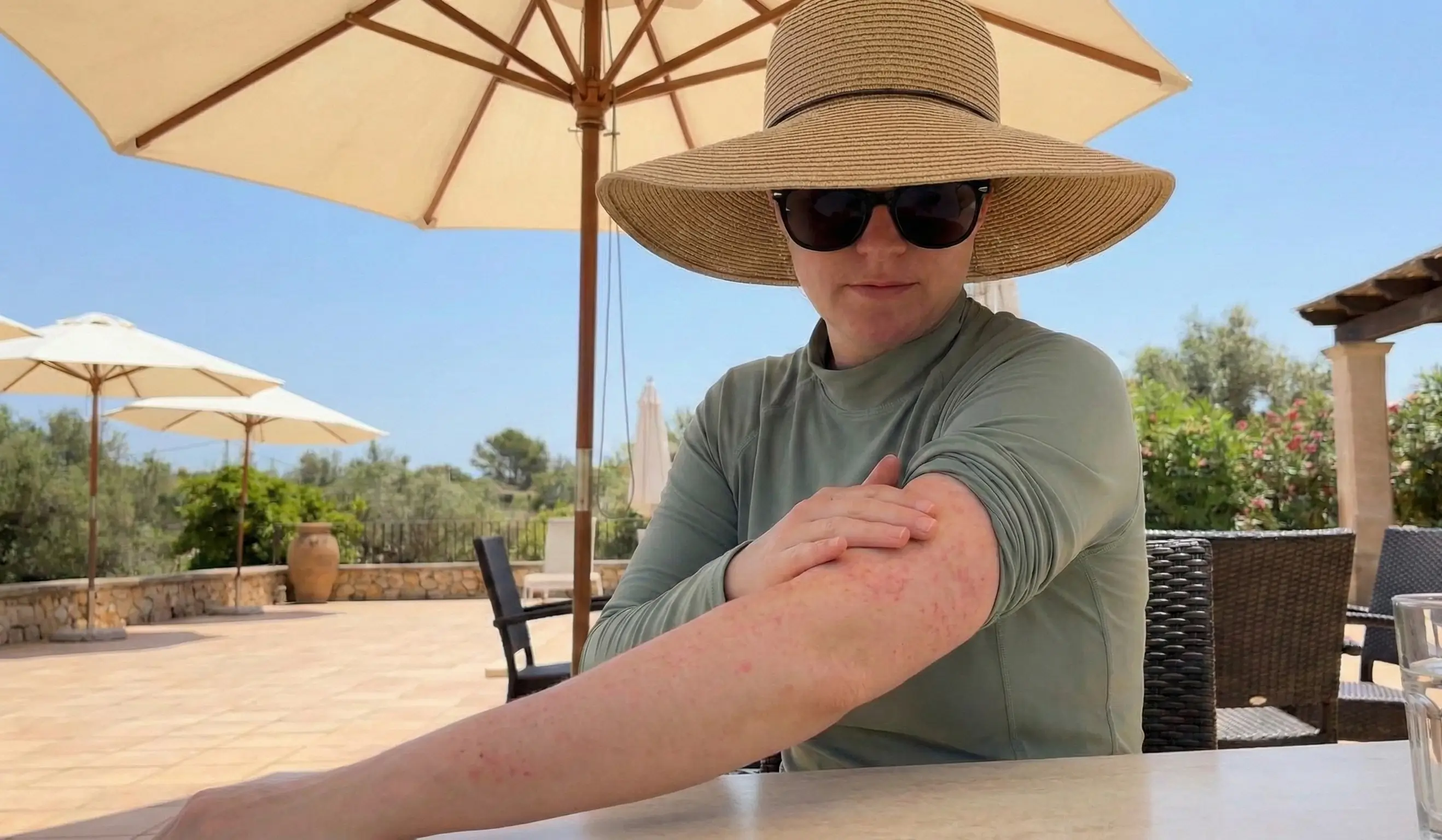 Femme assise sous un parasol avec des taches rouge sur le bras gauche causé par une allergie au soleil