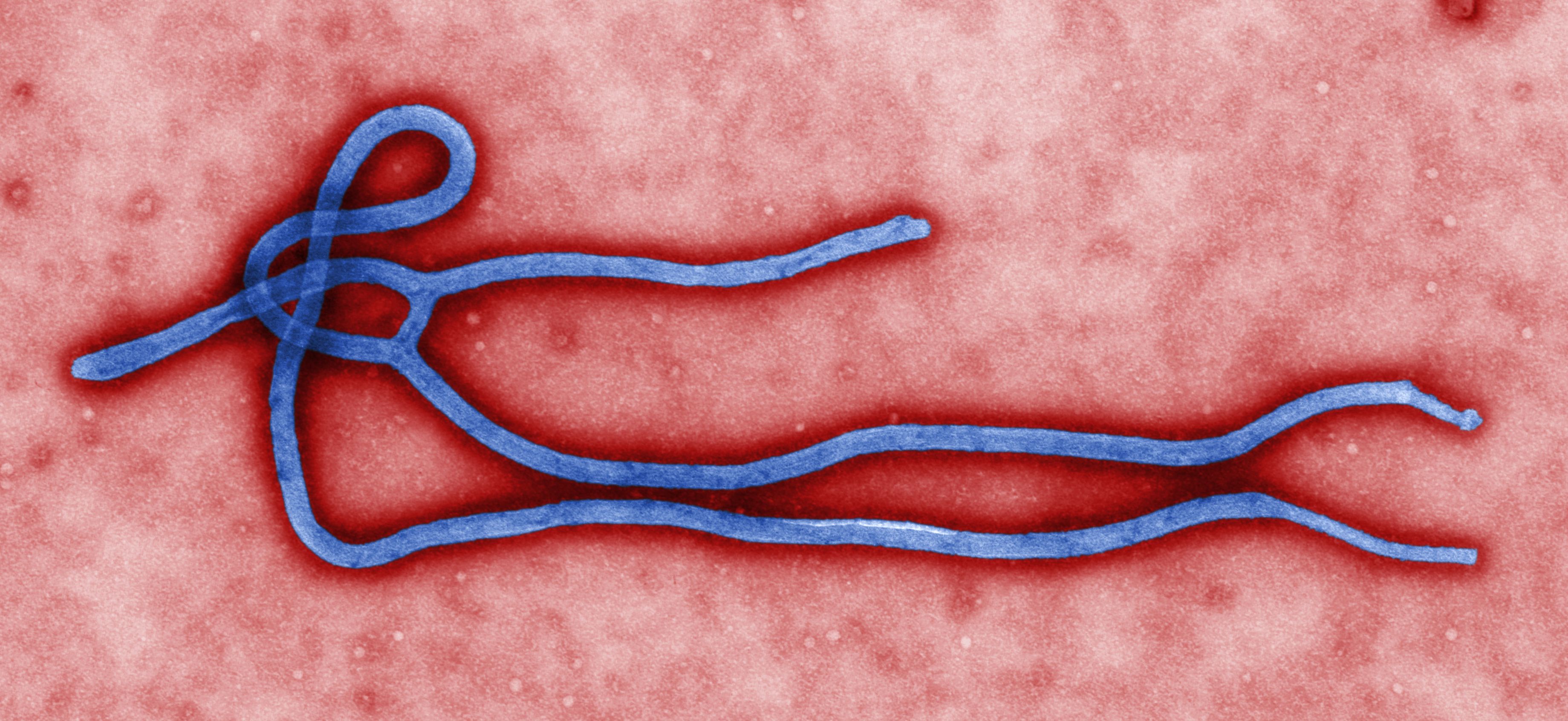 Virion du virus Ebola vu au microscope électronique à transmission